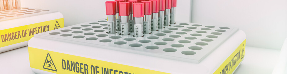 Laboratory test for coronavirus. Danger of Infection.