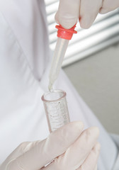 Professional doctor lab technician holding blood sample with novel covid-19 coronavirus glass pipette to test tube