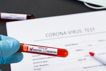 blood test tube to examine the corona virus