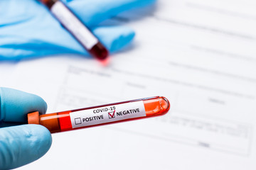 blood test tube to examine the corona virus