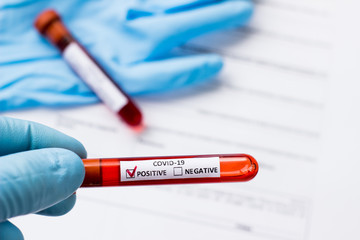 blood test tube to examine the corona virus