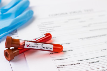 blood test tube to examine the corona virus