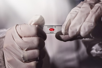 Test and sample virus crown covid virus 19