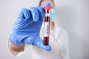  Nurse holding blood sample infected with Coronavirus wearing protective gloves. Pandemic COVID-19