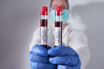 Doctor holding positive and negative blood sample infected with Coronavirus, wearing mask and...