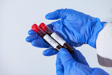 Doctor holding positive and negative blood sample infected with Coronavirus, wearing mask and...