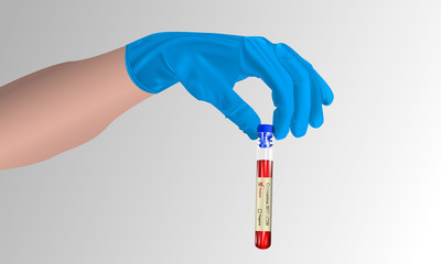 Realistic test tube in hand with a coronavirus test (2019-nCOV) on a gray background, concept of a positive result on COVID-2019, vector illustration