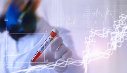 Background researcher in the laboratory is testing drugs for the treatment of viral pneumonia. Coronovirus blood test of infected patients. World pandemic.