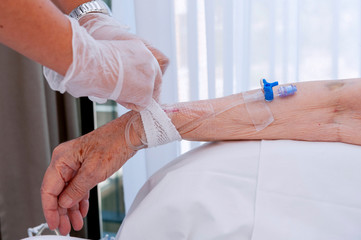 Closeup of an old man's arm with a catheter