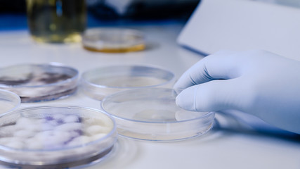 Scientific handling Microbiological cultures in a petri dish for pharmaceutical bioscience...