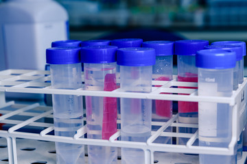 Laboratory test tubes in rack. Concept of science, laboratory and study of diseases. Coronavirus (COVID-19) treatment developing.