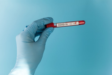Fototapeta premium Positive blood test result for the new rapidly spreading Coronavirus