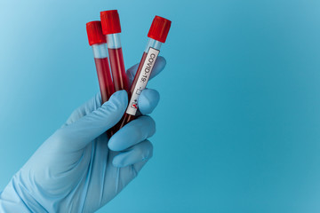 Positive blood test result for the new rapidly spreading Coronavirus