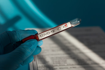 Obraz premium Positive blood test result for the new rapidly spreading Coronavirus