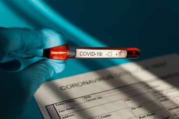 Positive blood test result for the new rapidly spreading Coronavirus