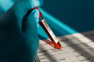 Positive blood test result for the new rapidly spreading Coronavirus