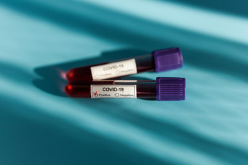 Positive blood test result for the new rapidly spreading Coronavirus