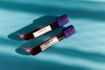 Positive blood test result for the new rapidly spreading Coronavirus