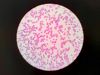 Red blood cell of frog was dyed by Wright's stain. The red blood cell was studied under light microscope.