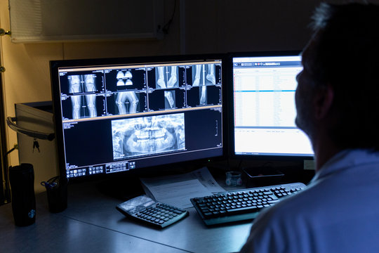 Médecin radiologue regarde radios sur écran dans bureau sombre