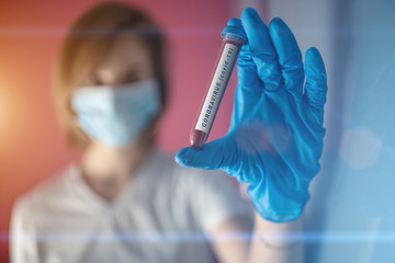 nurse wearing a mask, analyzes test tube of blood infected by coronavirus, generated in china, widespread in Italy and also arrived in the us with the risk of a 2019-ncov flu pandemic and deaths 