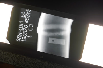 Unbrakable control. X-ray of the weld of the pipeline. Weld marriage. The accumulation of pores.
