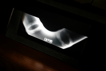 Unbrakable control. X-rays of the welds of the process pipeline at the petrochemical enterprise....