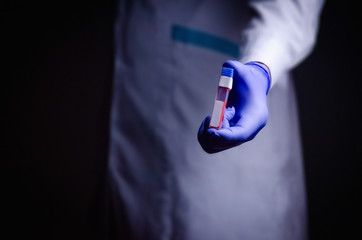 doctor holds a coronavirus in his hand a blood test with the inscription covid-19 medical gloves concept for the treatment of a pandemic virus epidemic quarantine