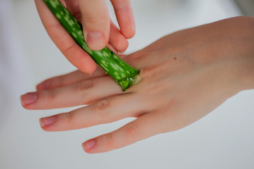 Female hand applying aloe vera gel on a skin burn.