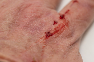 Close-up of a bloody cut on a hand