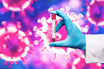 Doctor in gloves holding BD Vacutainer in his hand against the background of the SARS-CoV-2 virus image