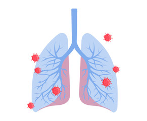 Concept Of Healthcare And Medicine, Epidemic Of Coronavirus 2019-Ncov. Infographic Of Infected Lungs. Virus Diagnosis And Treatment. Necessity Of Vaccination. Cartoon Flat Style. Vector Illustration