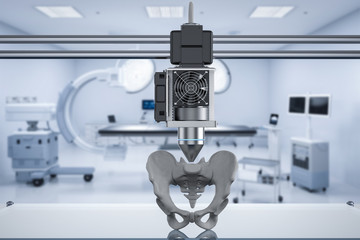 3d printer print prosthetic hip bone