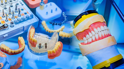 Naklejka premium Dentistry. Layouts of jaws on the doctor's desktop. Dental care. Elimination of problems with teeth. Denture. Correction of bite. Visual AIDS for teaching students.