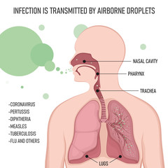 Obraz premium nfection is transmitted by airborne droplets. Human body with lungs affected by virus cells through the respiratory tract.