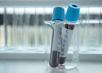 Chemical or medicine or vaccine or test tube with blood sample for COVID-19 test in medical laboratories or chemistry laboratory.Coronavirus blood test,Virus outbreak,anti-coronavirus research concept