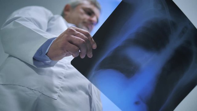 doctor look at chest  lung x-rays infected by coronavirus,low angle of physician checking chest xray affected by pneumonia