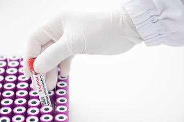 Doctor hand holding blood test tube  for  analysis.Laboratory testing patient’s blood samples.Conceptual image coronavirus (COVID-19) test tube sample that has tested positive for coronavirus.