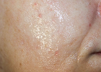 Fototapeta premium Transparent mask on a woman 's face close -up. Macro.