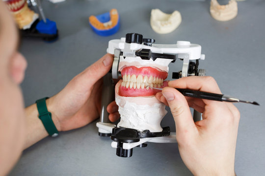 dental technician works with dental prostheses and creates a natural gum