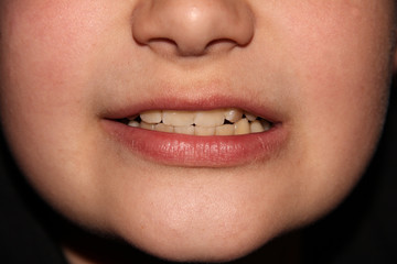 Naklejka premium Boy's smile macro photography. Baby's teeth. The lower part of the face