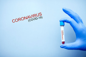 Test tube with blood sample for COVID-19 test, novel coronavirus 2019 found in Wuhan, China