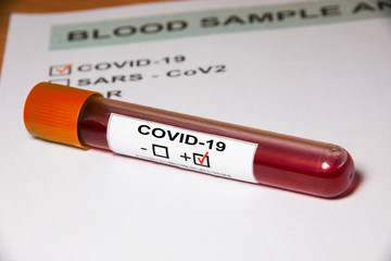 Result form and Blood sample test tube positive with COVID-19 or novel coronavirus