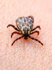 Lyme Disease Infected Tick Insect Crawling on Skin. Encephalitis Virus or Lyme Borreliosis Disease Infectious Dermacentor Tick Arachnid Parasite Macro.