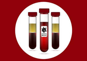 Three test tube with blood and serum with label COVID-19
