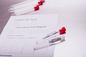 The United States under the threat of the global coronavirus covid-19 pandemic performs thousands...