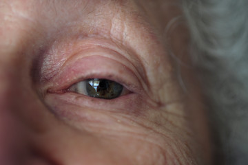 Senior woman's eye