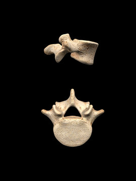 Lumbar L5 Vertebra Top And Side Views On Black Background