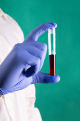 A close-up of a test tube with a blood sample. Corona. Coronavirus test.