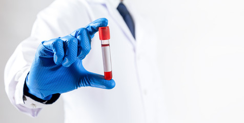 Doctor hand holding blood tube test.